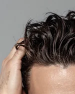 Radiofrecuencia Capilar