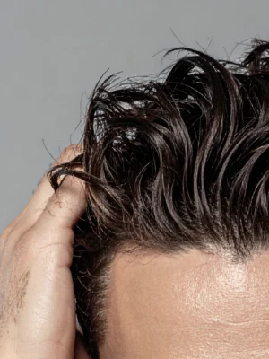 Radiofrecuencia Capilar