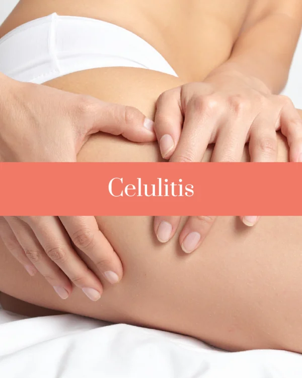 Cellu Smooth Depilife España como tratar celulitis Cellu Smooth