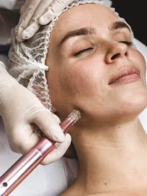Bioestimulación facial con Exosomas