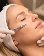 Dermaplaning